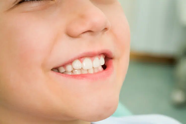 How To Get Your Children To Clean Their Teeth