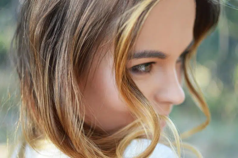 Beyond Skin Impact of Vitiligo