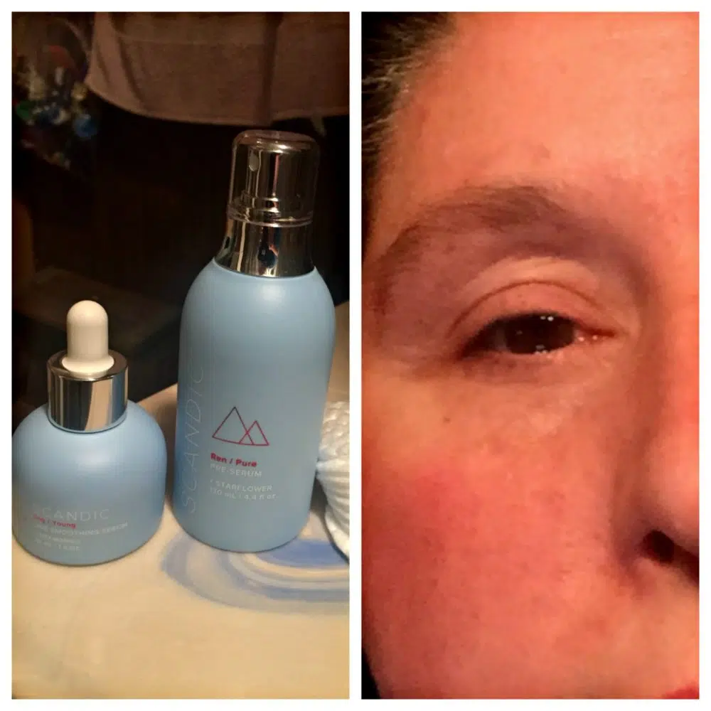 SC&Auml;NDIC Skincare is my Fountain of Youth!