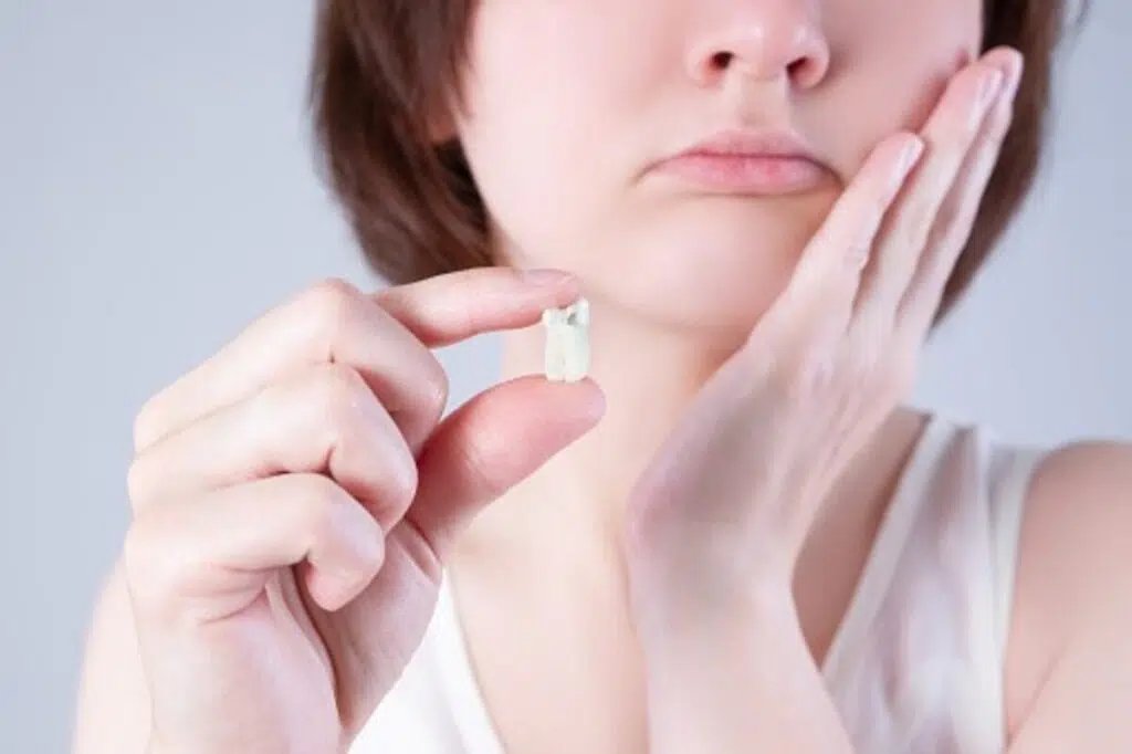 How To Tell If You Have Bad Teeth
