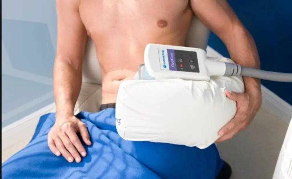 All About Coolsculpting