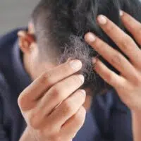 Wellness And Appearance Tips: What Should One Do When Facing A Receding Hairline