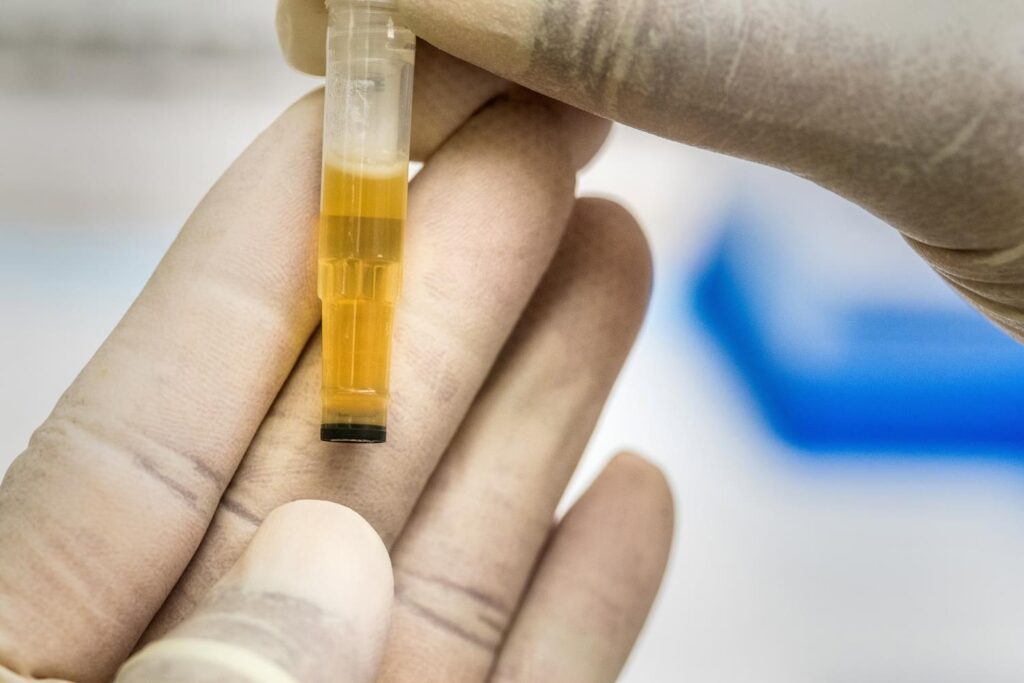Why Should You Organize Random Drug Testing At The WorkPlace?