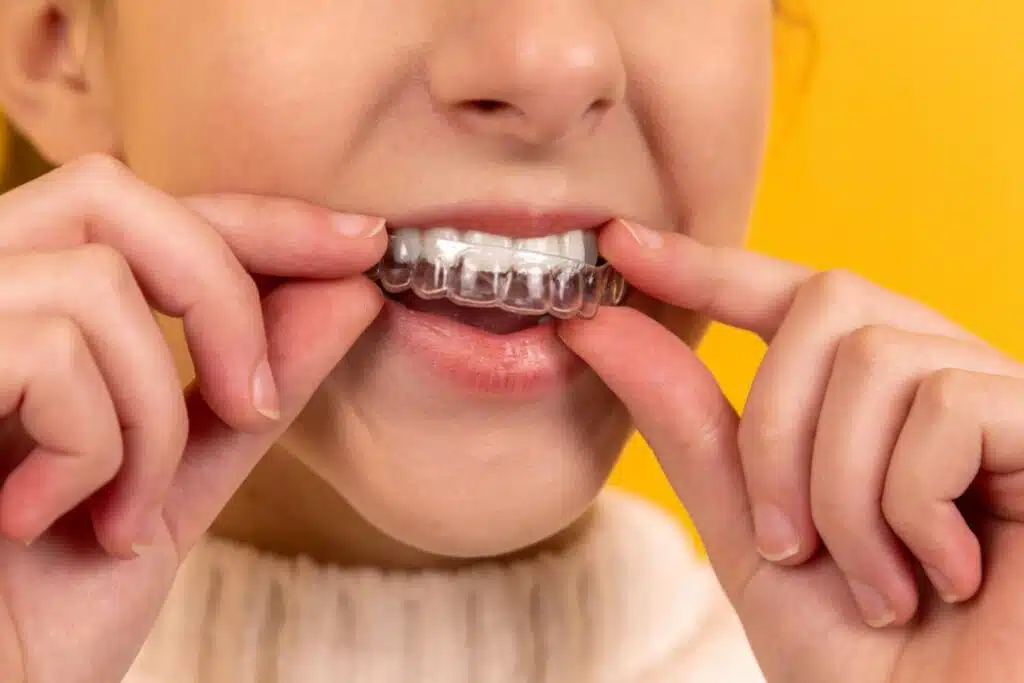 6 Ways You Can Take Care Of Your Teeth