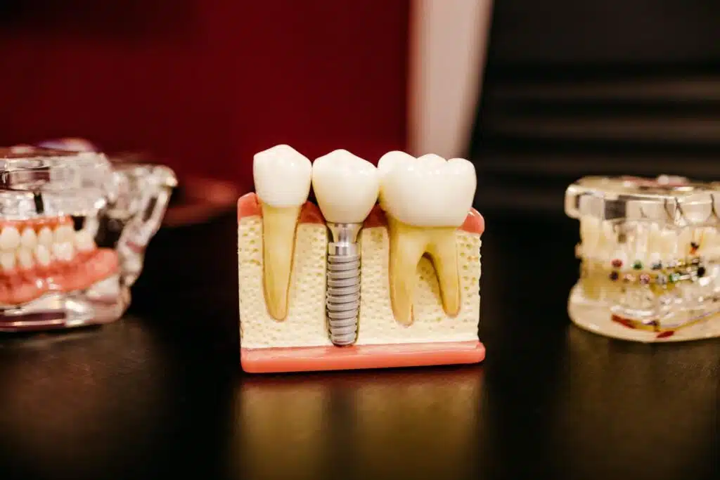 6 Ways You Can Take Care Of Your Teeth
