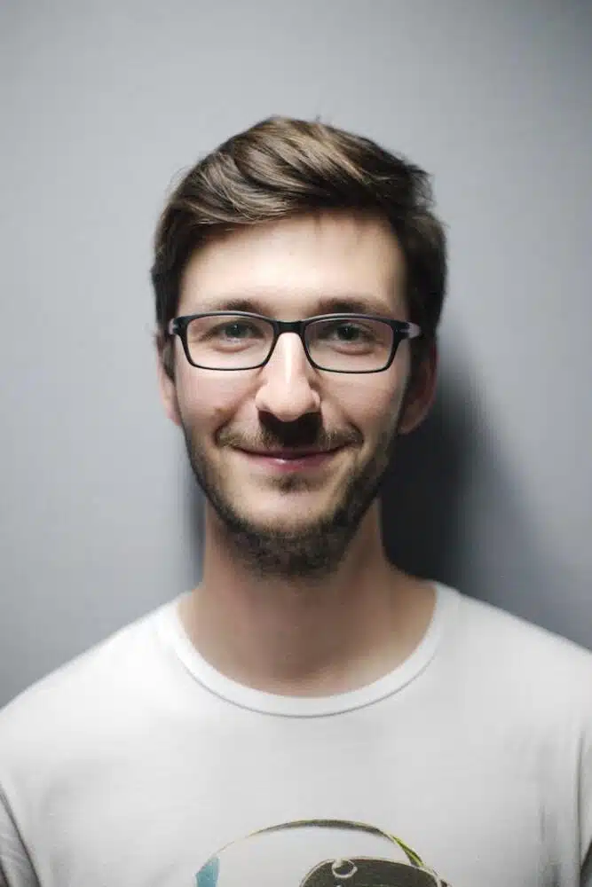 Procedure, Complications During And After Hair Transplant
