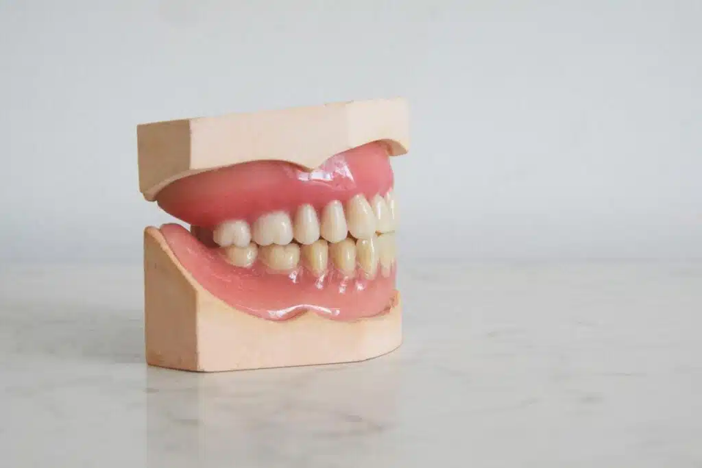 Dental Implants: The Ultimate Guide You Should Know About This Orthodontic Treatment