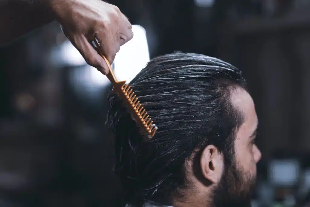 The Cost Of Hair Transplants: Is It Worth It?
