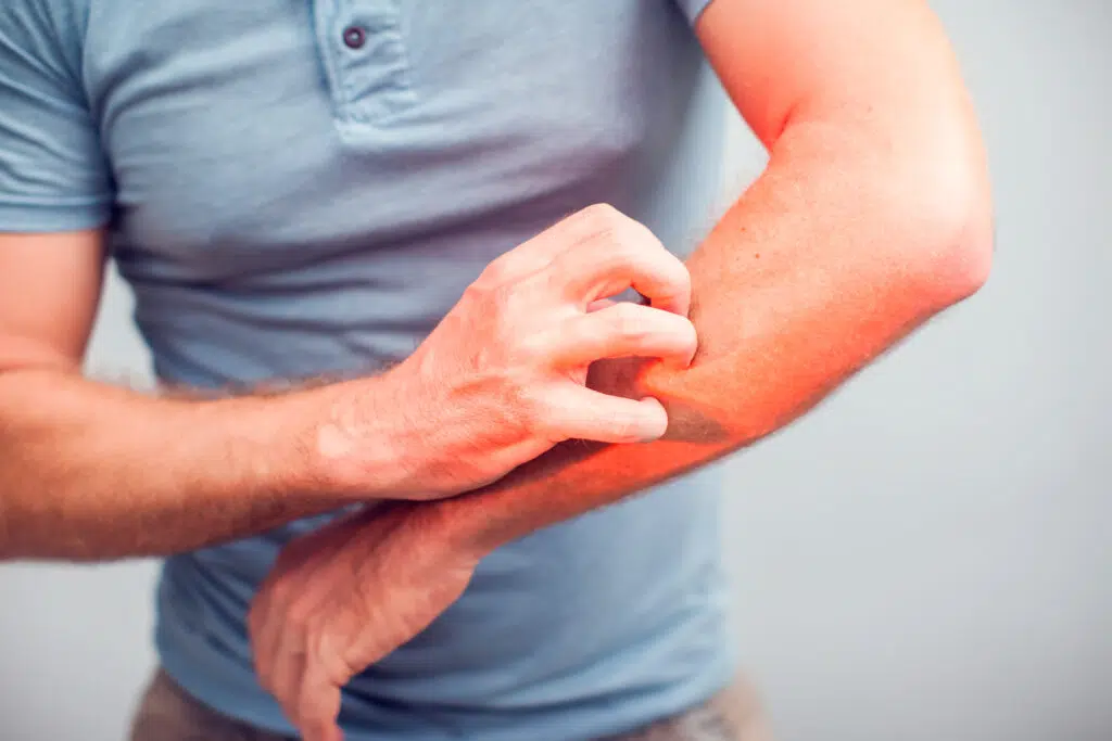 blood sugar spikes